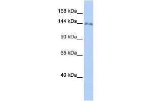 WB Suggested Anti-ZNF862 Antibody Titration:  0. (ZNF862 antibody  (N-Term))