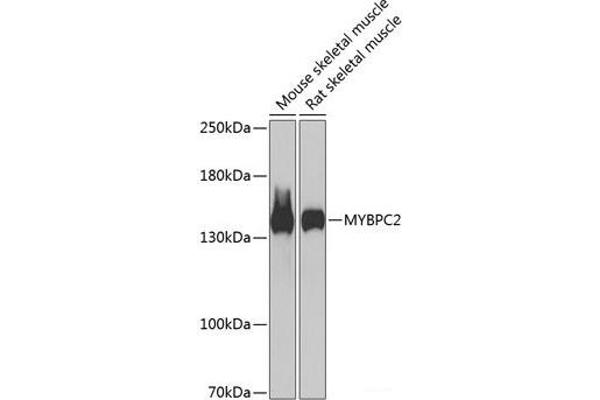 MYBPC2 抗体