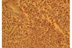 Immunohistochemistry (IHC) image for anti-Chemokine (C-C Motif) Receptor 4 (CCR4) (AA 17-39) antibody (ABIN2478968) (CCR4 antibody  (AA 17-39))
