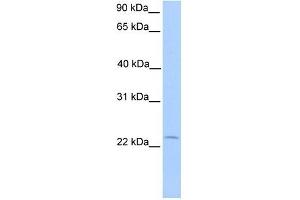 C5ORF39 antibody used at 1 ug/ml to detect target protein. (Chromosome 5 Open Reading Frame 39 (C5orf39) (N-Term) antibody)