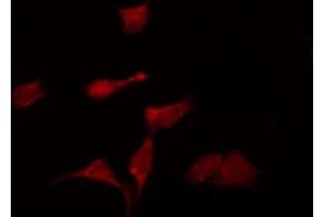 ABIN6275375 staining Hela by IF/ICC. (KCNK6 antibody  (C-Term))