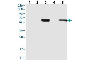 Western blot analysis of Lane 1: RT-4, Lane 2: U-251 MG, Lane 3: Human Plasma, Lane 4: Liver, Lane 5: Tonsil with C1RL polyclonal antibody .