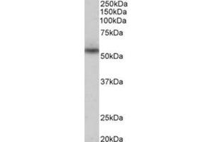 AP31776PU-N SLC47A2 antibody staining of Human heart lysate at 0. (Mare/Nprl3/C16orf35 antibody  (Internal Region, N-Term))