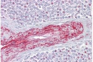Anti-SLA antibody IHC staining of human spleen. (SLA antibody  (C-Term))