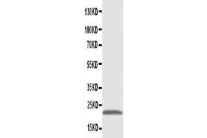 Anti-PMVK antibody, Western blotting WB: Rat Cardiac Muscle Tissue Lysate (PMVK antibody  (Middle Region))