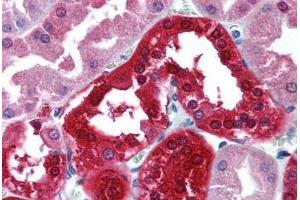 Human Kidney (formalin-fixed, paraffin-embedded) stained with CA2 antibody ABIN305738 at 5 ug/ml followed by biotinylated goat anti-rabbit IgG secondary antibody ABIN481713, alkaline phosphatase-streptavidin and chromogen. (CA2 antibody  (HRP))