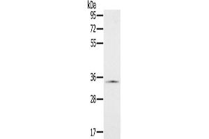 Western Blotting (WB) image for anti-NADH Dehydrogenase (Ubiquinone) 1 alpha Subcomplex, 9, 39kDa (NDUFA9) antibody (ABIN2423847)