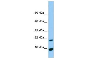 Host:  Rabbit  Target Name:  Timm17a  Sample Type:  Rat Pancreas lysates  Antibody Dilution:  1. (TIMM17A antibody  (N-Term))