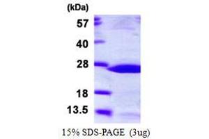 Image no. 1 for Heat Shock 27kDa Protein 2 (HSPB2) protein (His tag) (ABIN1098621) (HSPB2 Protein (His tag))