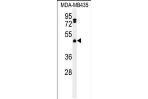 Western blot analysis of FBXL2 Antibody in MDA-MB435 cell line lysates (35ug/lane) (FBXL2 antibody  (C-Term))