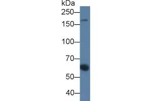 Detection of a2M in Porcine Serum using Monoclonal Antibody to Alpha-2-Macroglobulin (a2M) (alpha 2 Macroglobulin antibody  (AA 616-856))