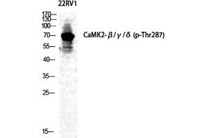 Western Blot analysis of 22RV1 cells using Phospho-CaMKIIβ/γ/δ (T287) Polyclonal Antibody diluted at 1:500. (CaMKIIbeta/gamma/delta antibody  (pThr287))