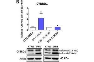 Expression of cytochrome b reductase (CYBRD1) and transferrin receptor 1 (TFR1) participating in iron uptake is higher in tumor-initiating cells (TICs)Expression of the CYBRD1 gene at the mRNA level in breast non-malignant cell line MCF10A, in TICs derived from breast cancer cell lines MCF-7, BT-474, T-47D and ZR-75-30 as well as from prostate cancer cell lines DU-145 and LNCaP has been determined (A) together with protein levels in the MCF-7 cell line (CTRL) and MCF-7 derived spheres (SPH) (B). (Cytochrome B Reductase 1 antibody  (AA 51-150))