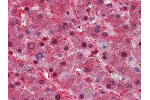 Immunohistochemical analysis of paraffin-embedded human Liver tissues using LPA mouse mAb (Lp(a) antibody)
