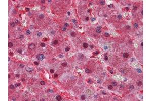 Immunohistochemical analysis of paraffin-embedded human Liver tissues using LPA mouse mAb
