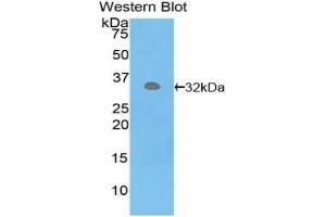 Detection of recombinant PCK1 using Polyclonal Antibody to Phosphoenolpyruvate Carboxykinase 1, Soluble (PCK1) (PCK1 antibody  (AA 311-558))