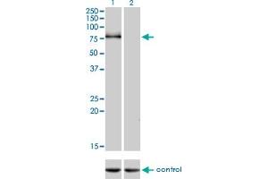 Western blot analysis of CDH6 over-expressed 293 cell line, cotransfected with CDH6 Validated Chimera RNAi (Lane 2) or non-transfected control (Lane 1). (CDH6 antibody  (AA 513-612))