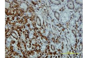 Image no. 2 for anti-serine/threonine Kinase 4 (STK4) (AA 1-40) antibody (ABIN598949) (STK4 antibody  (AA 1-40))