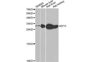 Western blot analysis of extracts of various cell lines, using EPO antibody (ABIN5973306) at 1/500 dilution. (EPO antibody)
