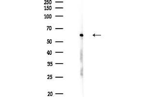 anti-Small Nuclear Ribonucleoprotein 70kDa (U1) (SNRNP70) (Internal Region) antibody