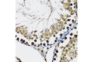Immunohistochemistry of paraffin-embedded rat testis using DDX41 antibody (ABIN5973951) at dilution of 1/100 (40x lens).