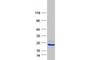 Validation with Western Blot (XAGE2 Protein (Myc-DYKDDDDK Tag))