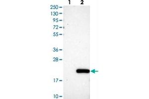 Western blot analysis of Lane 1: Negative control (vector only transfected HEK293T lysate), Lane 2: Over-expression Lysate (Co-expressed with a C-terminal myc-DDK tag (~3. (C11orf1 antibody)