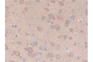 Detection of CS in Rat Brain Tissue using Polyclonal Antibody to Citrate Synthase (CS) (CS antibody  (AA 56-312))