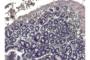 (ABIN184983) Negative Control showing staining of paraffin embedded Human Colon, with no primary antibody. (TRIM5 antibody  (N-Term))