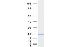 CSNK2B Protein (Myc-DYKDDDDK Tag)