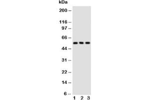 Western blot testing of GLUT5 antibody and Lane 1:  rat kidney;  2: rat liver;  3: mouse kidney tissue lysate (SLC2A5 antibody  (Middle Region))