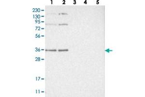 Western blot analysis of Lane 1: RT-4, Lane 2: U-251 MG, Lane 3: Human Plasma, Lane 4: Liver, Lane 5: Tonsil with WRNIP1 polyclonal antibody  at 1:250-1:500 dilution. (WRNIP1 antibody)