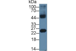 Western Blot; Sample: Mouse Testis lysate; Primary Ab: 1µg/ml Rabbit Anti-Human HMGB4 Antibody Second Ab: 0. (HMGB4 antibody  (AA 25-167))