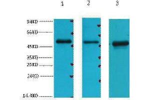 Western Blotting (WB) image for anti-Fumarate Hydratase (FH) antibody (ABIN3181143) (FH antibody)