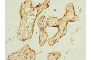 Immunohistochemistry of paraffin-embedded human placenta tissue using ABIN7175802 at dilution of 1:100 (WDR89 antibody  (AA 1-387))