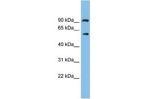 WB Suggested Anti-ALDH7A1 Antibody Titration: 0. (ALDH7A1 antibody  (N-Term))