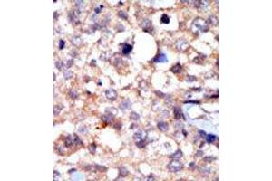 Image no. 2 for anti-C-Abl Oncogene 1, Non-Receptor tyrosine Kinase (ABL1) (C-Term) antibody (ABIN359966) (ABL1 antibody  (C-Term))