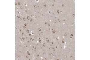 Immunohistochemical staining of human hippocampus with PPP2R3A polyclonal antibody  shows moderate cytoplasmic positivity in neuronal cells at 1:200-1:500 dilution.