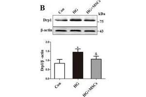 MSCs attenuate HG-induced mitochondrial dysfunction. (beta Actin antibody  (AA 1-375))