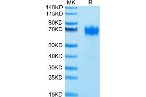 Biotinylated Human CSF2R on Tris-Bis PAGE under reduced conditions. (CSF2RA Protein (His-Avi Tag,Biotin))