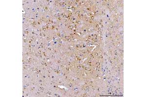 IHC analysis of SRGAP3 using anti-SRGAP3 antibody (ABIN7602538). (SRGAP3 antibody  (AA 824-1067))