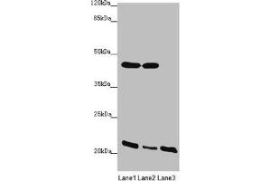 Western blot All lanes: ZDHHC16 antibody at 1. (ZDHHC16 antibody  (AA 288-377))