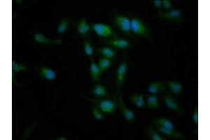 Immunofluorescence staining of Hela cells with ABIN7149425 at 1:266, counter-stained with DAPI. (NT5C2 antibody  (AA 487-553))