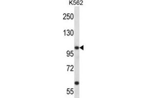 Western Blotting (WB) image for anti-Potassium Voltage-Gated Channel, Shaw-Related Subfamily, Member 3 (KCNC3) antibody (ABIN2998065) (KCNC3 antibody)