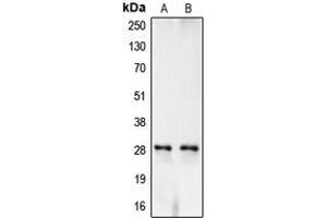 Western blot analysis of Carbonic Anhydrase 1 expression in TF1 (A), K562 (B) whole cell lysates.