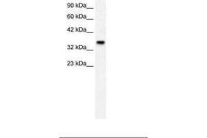 Image no. 2 for anti-Forkhead Box F1 (FOXF1) (AA 292-341) antibody (ABIN202327) (FOXF1 antibody  (AA 292-341))