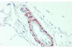 Detection of IL3 in Human Skeletal Muscle Tissue using Polyclonal Antibody to Interleukin 3 (IL3) (IL-3 antibody  (AA 20-152))