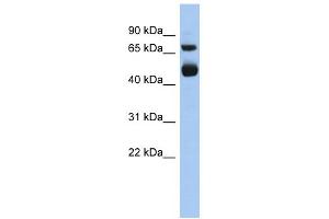 WB Suggested Anti-ALOX15 Antibody Titration: 0. (ALOX15 antibody  (Middle Region))