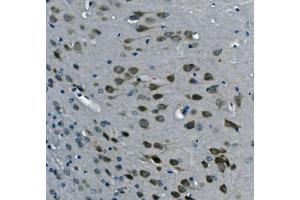IHC analysis of PCBP2/hnRNP E2 using anti-PCBP2/hnRNP E2 antibody (ABIN7600449). (PCBP2 antibody  (AA 197-276))