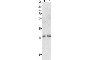 Gel: 12 % SDS-PAGE, Lysate: 60 μg, Lane 1-2: Human fetal liver tissue, hela cells, Primary antibody: ABIN7190766(GCH1 Antibody) at dilution 1/200, Secondary antibody: Goat anti rabbit IgG at 1/8000 dilution, Exposure time: 15 minutes (GCH1 antibody)